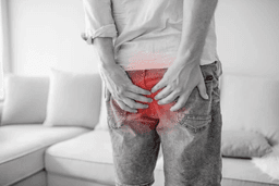 Piles Hemorrhoids