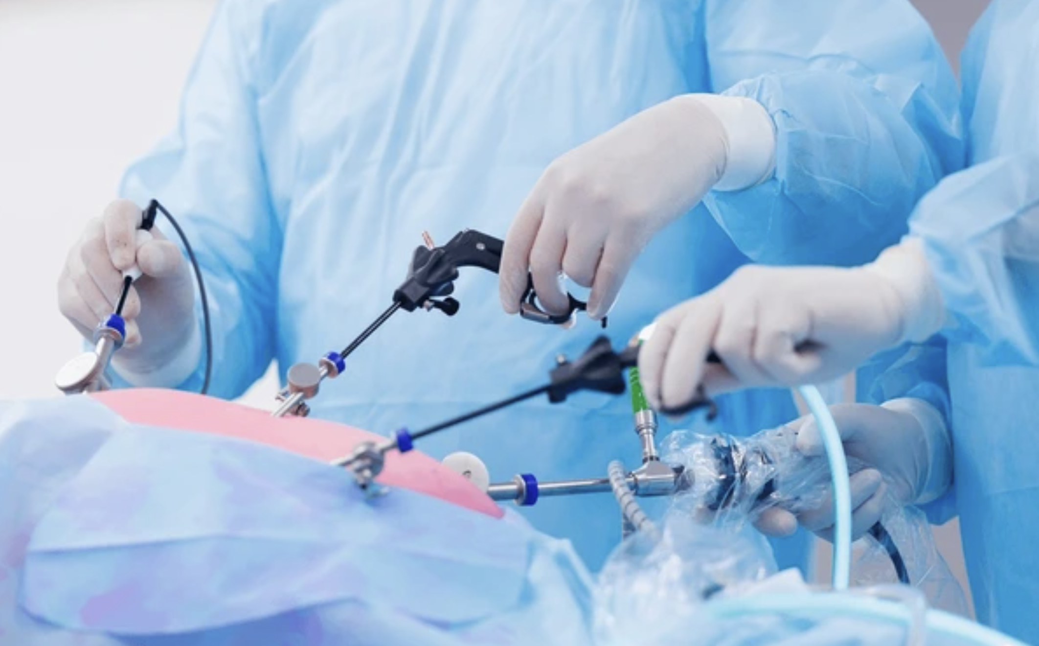 Diagnostic Laparoscopy - Laparoscopic surgery by Dr. Jaya Maheshwari