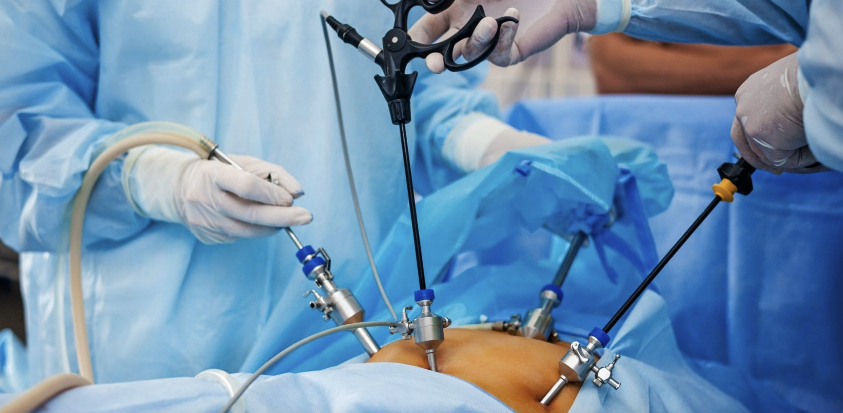 Laparoscopic Removal of Uterus - Laparoscopic surgery by Dr. Jaya Maheshwari