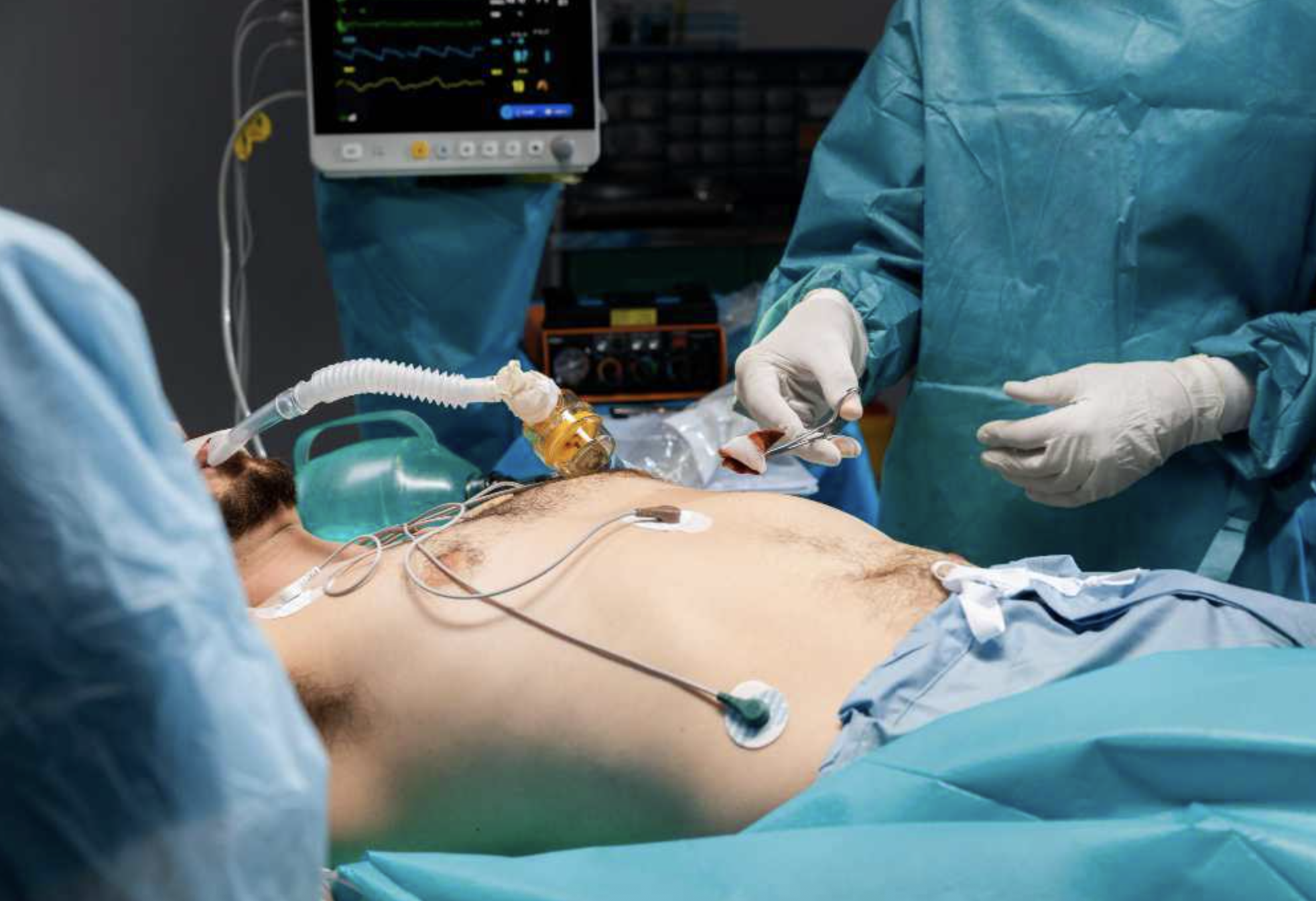 Laparoscopic Gall Bladder Removal - Laparoscopic surgery by Dr. Jaya Maheshwari