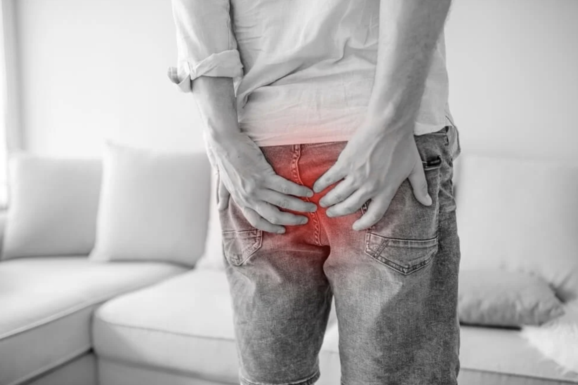 Piles: Hemorrhoids